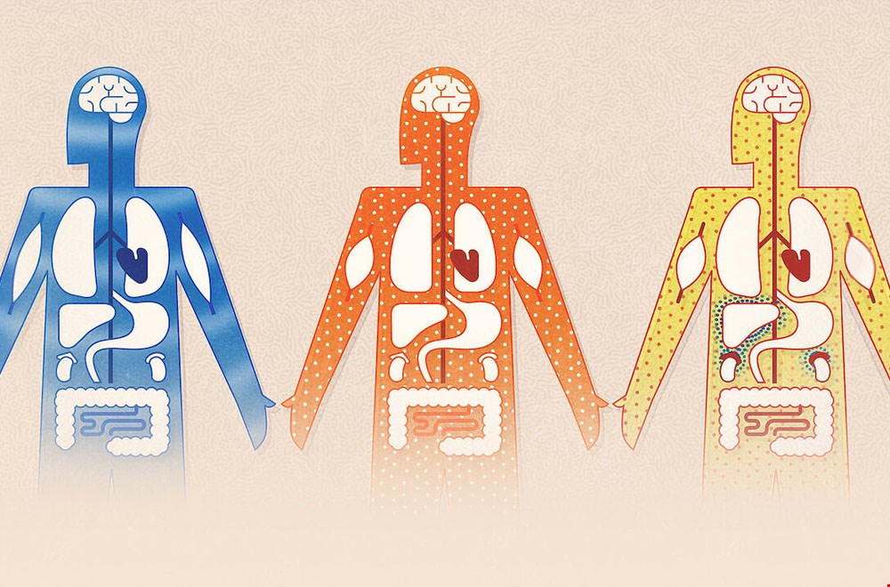 Coronavirus, Explained Coronavirus, Explained